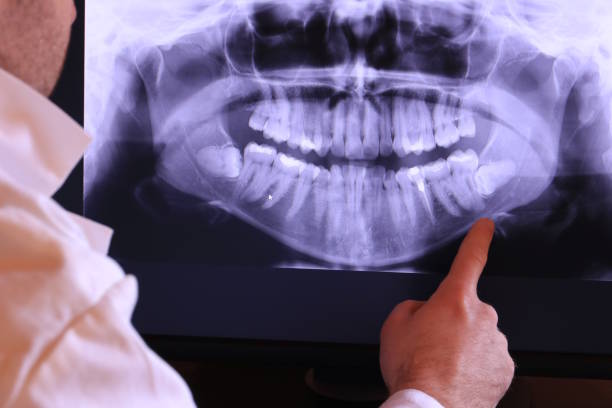 Best After-Hours Emergency Dentist in Port Angeles, WA